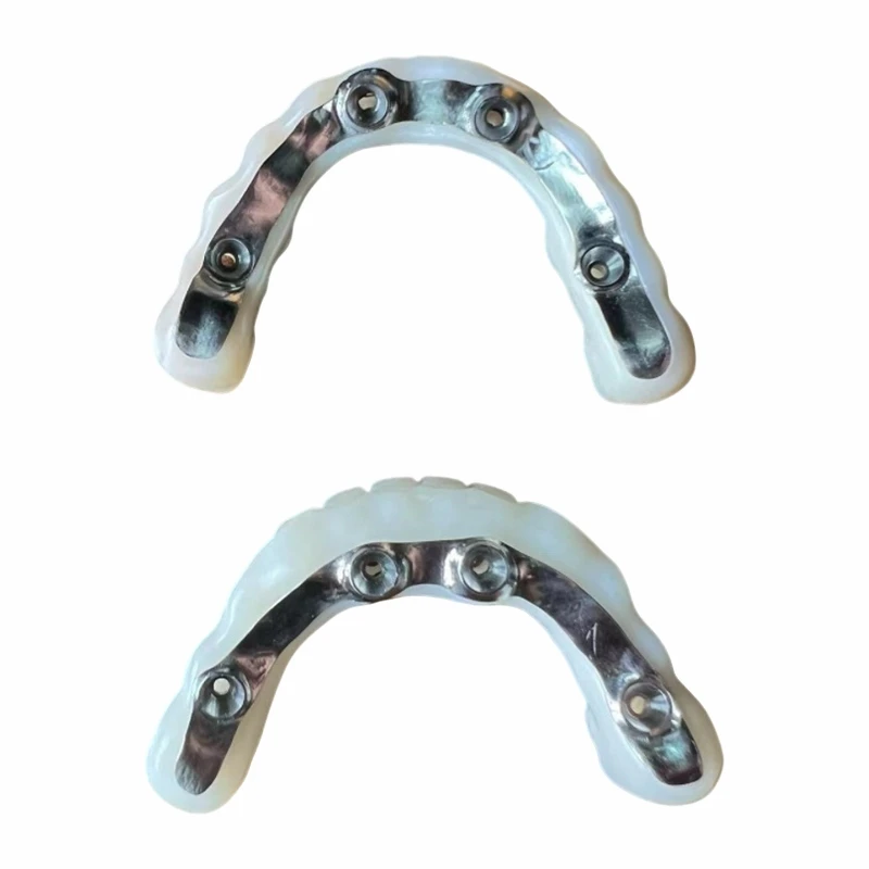 Pod din zirconiu cu gura completa implant cu Ti Bar