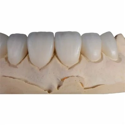 Sticlă disilicat de litiu-Fechir ceramic